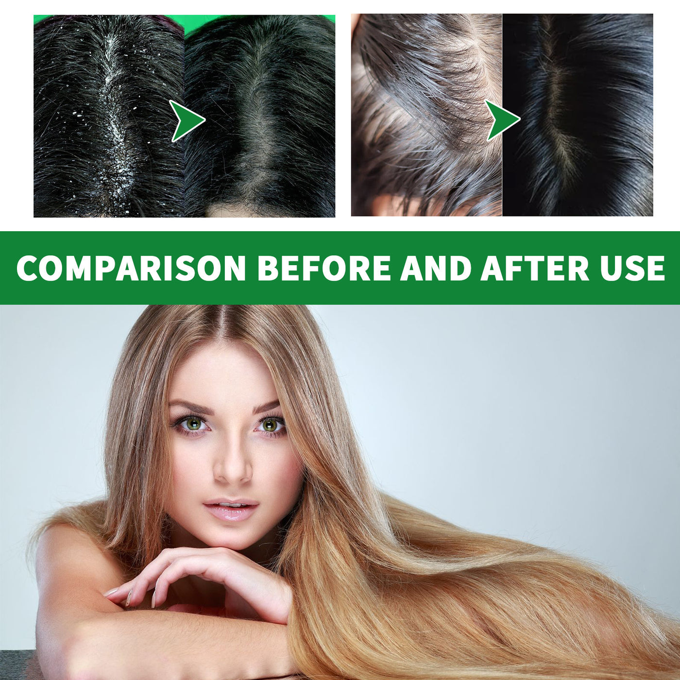 Cleansing Scalp Dandruff Soft Fluffy Shampoo