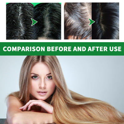 Cleansing Scalp Dandruff Soft Fluffy Shampoo